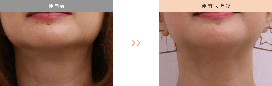 クリスタルトマト使用効果